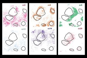 هوش مصنوعی CellLENS در درمان سرطان